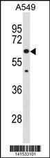 Anti-KLHL30 Rabbit Polyclonal Antibody (AP (Alkaline Phosphatase))