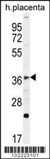 Anti-FOXI1 Rabbit Polyclonal Antibody (Biotin)