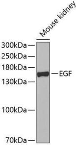 Western blot analysis of extracts of mouse kidney, using Anti-EGF Antibody (A11553) at 1:500 dilution. The secondary antibody was Goat Anti-Rabbit IgG H&L Antibody (HRP) at 1:10,000 dilution.