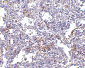 Anti-TMC6 Rabbit Polyclonal Antibody