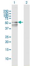 Anti-RBMY1F Mouse Polyclonal Antibody