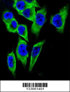 Anti-LDHA Rabbit Polyclonal Antibody