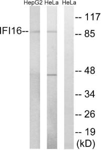 Western blot analysis of lysates from HeLa and HepG2 cells using Anti-IFI16 Antibody The right hand lane represents a negative control, where the antibody is blocked by the immunising peptide