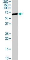 Anti-HDAC2 Rabbit Polyclonal Antibody