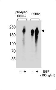 Anti-ERBB2 Rabbit Polyclonal Antibody (FITC (Fluorescein Isothiocyanate))