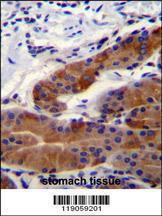 Anti-DFNB31 Rabbit Polyclonal Antibody (Biotin)