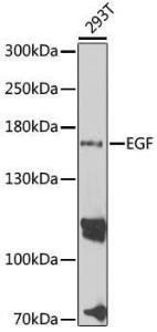 Western blot analysis of extracts of 293T cells, using Anti-EGF Antibody (A11553) at 1:1,000 dilution. The secondary antibody was Goat Anti-Rabbit IgG H&L Antibody (HRP) at 1:10,000 dilution.