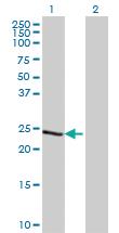 Anti-TCEAL1 Mouse Monoclonal Antibody [clone: 2B5]