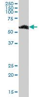 Anti-RBMY1F Mouse Polyclonal Antibody