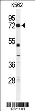 Anti-CNGA2 Rabbit Polyclonal Antibody