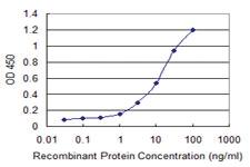 Anti-LRG1 Mouse Monoclonal Antibody [clone: 1H1]