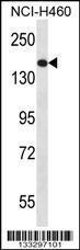 Anti-NPC1 Rabbit Polyclonal Antibody (FITC (Fluorescein Isothiocyanate))