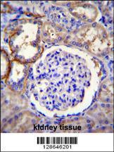 Anti-FA96A Rabbit Polyclonal Antibody (FITC (Fluorescein Isothiocyanate))