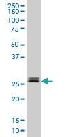 Anti-TGIF2 Mouse Monoclonal Antibody [clone: 2F3]