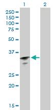 Anti-RBM11 Mouse Polyclonal Antibody