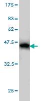 Anti-SMC1A Mouse Monoclonal Antibody [clone: 1B9]