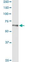 Anti-HLX Antibody Pair