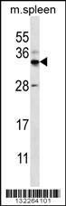 Anti-FOXI2 Rabbit Polyclonal Antibody (AP (Alkaline Phosphatase))