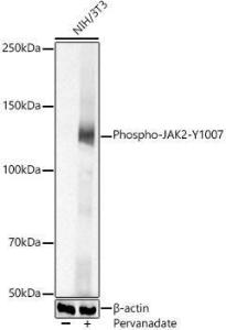 Western blot analysis of extracts of various cell lines, using Anti-JAK2 (phospho Tyr1007) Antibody (A306388) at 1:700 dilution