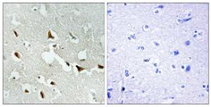 Antibody anti-IRS-1 A97024-100 100 µg