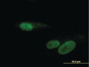 Anti-RBMY1F Mouse Polyclonal Antibody