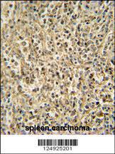 Anti-RNT2 Rabbit Polyclonal Antibody (Biotin)