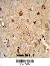 Anti-CES5A Rabbit Polyclonal Antibody (PE (Phycoerythrin))