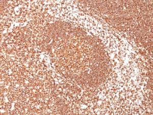 Immunohistochemical analysis of formalin-fixed, paraffin-embedded human tonsil (10X) using Anti-CD45 Antibody [2B11]