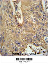 Anti-IL5RA Rabbit Polyclonal Antibody (FITC (Fluorescein Isothiocyanate))