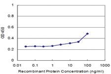 Anti-TCEAL1 Mouse Monoclonal Antibody [clone: 2B5]