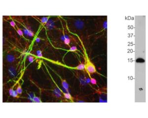 Left: Analysis of alpha-synuclein expression in mixed rat neuron-glial cultures by ICC. The alpha-synuclein antibody (red) stains vesicular structures the perikarya and processes of the neurons. Green: MAP2, Blue: DNA. Right: Detection of alpha-synuclein monomer in crude rat brain extract by WB.