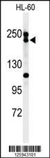 Anti-BLM Rabbit Polyclonal Antibody