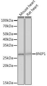 Western blot analysis of extracts of various cell lines, using Anti-BNIP1 Antibody [ARC2137] (A306390) at 1:1000 dilution. The secondary Antibody was Goat Anti-Rabbit IgG H&L Antibody (HRP) at 1:10000 dilution. Lysates/proteins were present at 25 µg per lane