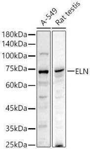 Anti-Elastin Rabbit Polyclonal Antibody