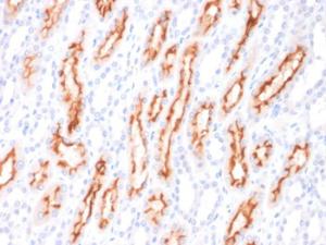 Immunohistochemical analysis of formalin-fixed, paraffin-embedded human renal cell carcinoma using Anti-TNFSF9 Antibody [CD137L/1547]