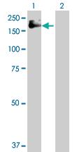 Anti-IGF1R Rabbit Polyclonal Antibody