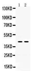 Anti-HSD11B2 Rabbit Polyclonal Antibody