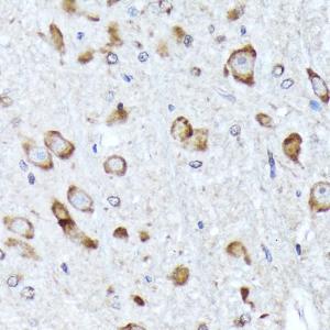 Immunohistochemistry analysis of paraffin-embedded rat brain using Anti-BNIP1 Antibody [ARC2137] (A306390) at a dilution of 1:100 (40X lens). Perform microwave antigen retrieval with 10 mM Tris/EDTA buffer pH 9.0 before commencing with IHC staining protocol