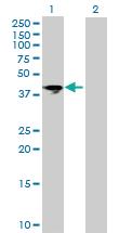 Anti-ARTC5 Mouse Polyclonal Antibody