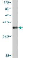 Anti-EIF4ENIF1 Mouse Polyclonal Antibody