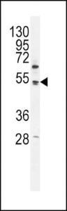 Anti-PDK4 Rabbit Polyclonal Antibody