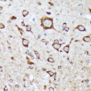 Immunohistochemistry analysis of paraffin-embedded mouse spinal cord using Anti-BNIP1 Antibody [ARC2137] (A306390) at a dilution of 1:100 (40X lens). Perform microwave antigen retrieval with 10 mM Tris/EDTA buffer pH 9.0 before commencing with IHC staining protocol