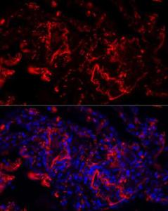 Anti-Elastin Rabbit Polyclonal Antibody