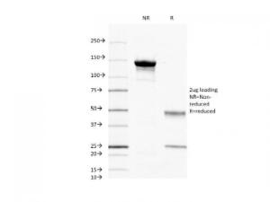 SDS-PAGE analysis of Anti-CD45 Antibody [2B11] under non-reduced and reduced conditions; showing intact IgG and intact heavy and light chains, respectively. SDS-PAGE analysis confirms the integrity and purity of the antibody.