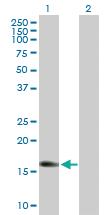 Anti-IGF2 Mouse Polyclonal Antibody