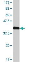 Anti-HSPB8 Mouse Monoclonal Antibody [clone: 5D7]