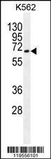 Anti-ATG16L2 Rabbit Polyclonal Antibody (Biotin)