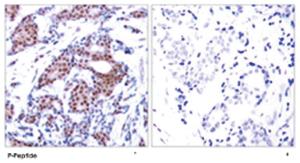 Anti-ELK1 Rabbit Polyclonal Antibody