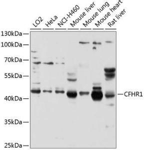 Western blot analysis of extracts of various cell lines, using Anti-CFHR1 Antibody (A11557) at 1:1000 dilution