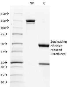 SDS-PAGE analysis of Anti-TNFSF9 Antibody [CD137L/1547] under non-reduced and reduced conditions; showing intact IgG and intact heavy and light chains, respectively. SDS-PAGE analysis confirms the integrity and purity of the antibody